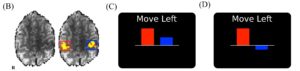 MOVE LEFT 300x71 - Difficulty moving arm/hand after stroke? Neurofeedback - Stroke Rehabilitation and Exercise Training for Survivors & Specialist Stroke Courses for Therapists and Trainers, Online and Face to Face