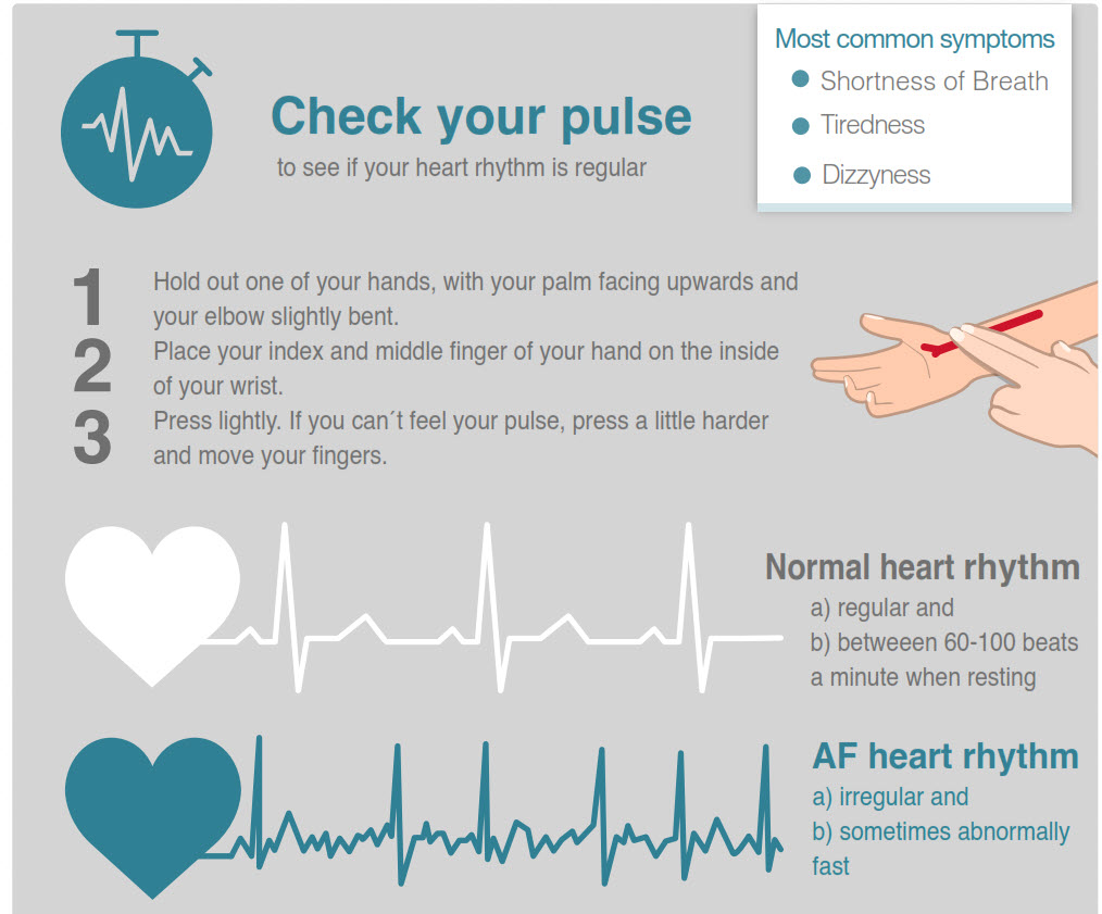 2018 10 11 20 23 01 - Atrial Fibrillation raises risk of stroke by 5: can you tell if you have it? - Stroke Rehabilitation and Exercise Training for Survivors & Specialist Stroke Courses for Therapists and Trainers, Online and Face to Face