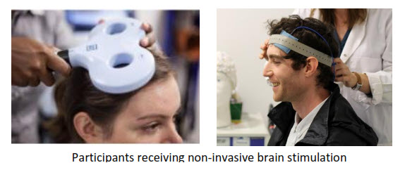 arni brain stimulation ucl - Can Brain Stimulation Help your Arm after Stroke? - Stroke Rehabilitation and Exercise Training for Survivors & Specialist Stroke Courses for Therapists and Trainers, Online and Face to Face