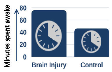 ARNI Oxford Sleep study 3 - Quality or Quantity of Sleep: Which Is Better for Rehab? - Stroke Rehabilitation and Exercise Training for Survivors & Specialist Stroke Courses for Therapists and Trainers, Online and Face to Face