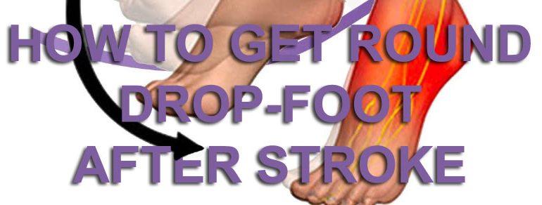 drop foot 1 770x292 - Home - Stroke Rehabilitation and Exercise Training for Survivors & Specialist Stroke Courses for Therapists and Trainers, Online and Face to Face