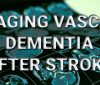 Managing Vascular Dementia  100x85 - Home - Stroke Rehabilitation and Exercise Training for Survivors & Specialist Stroke Courses for Therapists and Trainers, Online and Face to Face